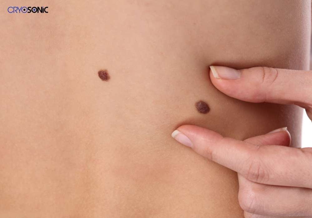 Infection Risk and Poor Aftercare Slough