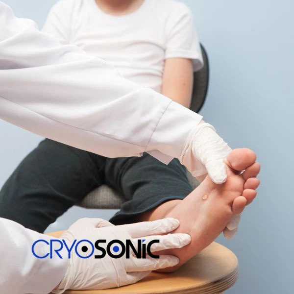 Are you looking for fast effective wart removal Contact us today Slough