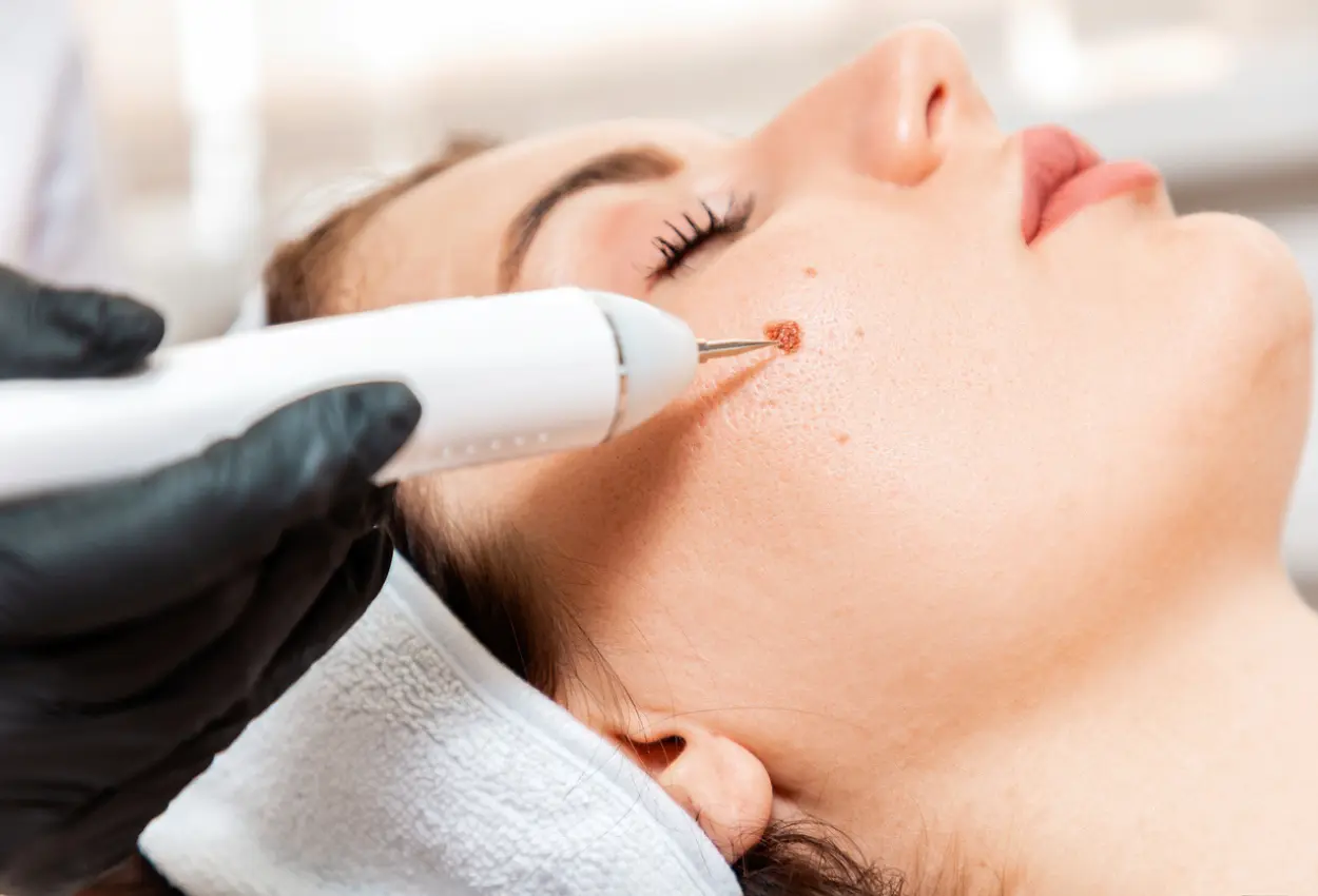 Frequently Asked Questions About Multiple Cryotherapy Treatments Slough