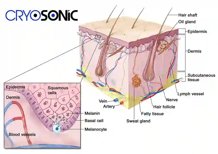 How Cryotherapy Stimulates Melanocyte Activity Slough